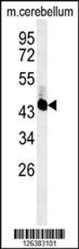 UBAC2 Antibody (N-term)