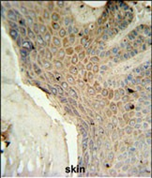 MFSD3 Antibody (Center)