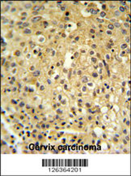 FYTD1 Antibody (N-term)