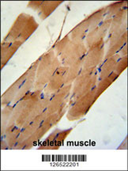 CNO6L Antibody (C-term)