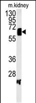 ATP6V1H Antibody (C-term)