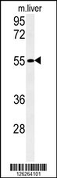 FAM151A Antibody (C-term)