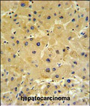 IFT20 Antibody (Center)