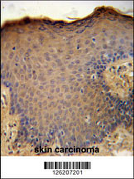 CXCL9 Antibody (C-term)