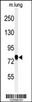 SEMA3C Antibody (C-term)