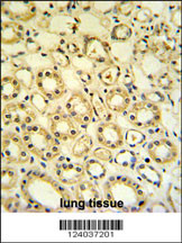 H6PD Antibody (C-term)