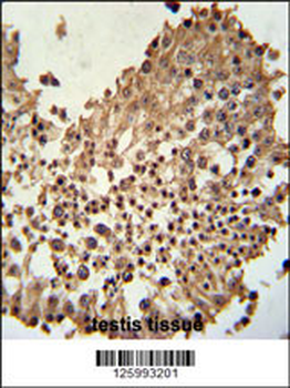 CCDC42 Antibody (Center)