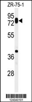 HAS1 Antibody (Center)