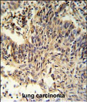 RXRA Antibody (Center)