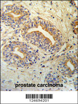 CWC15 Antibody (Center)