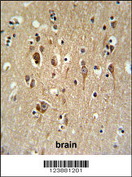 FA2H Antibody (Center)