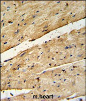 B3GNT7 Antibody (Center)