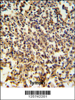 RNASEH2B Antibody (Center)