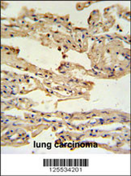 IFM2 Antibody (N-term)