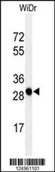 PAQR3 Antibody (C-term)