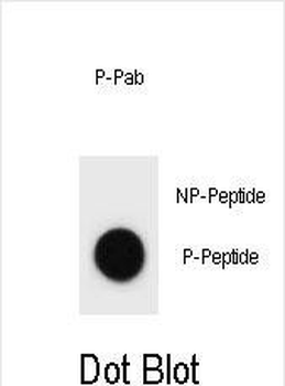 Phospho-CCNB3(T280) Antibody