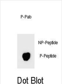 Phospho-BAD(S74) Antibody