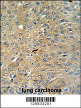 Cleaved-CASP3 (Asp175) Antibody