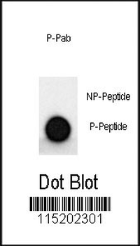 Phospho-MAP2(S1539) Antibody