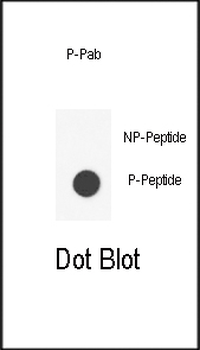 Phospho-IL6ST(Y905) Antibody