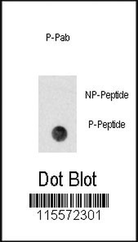 Phospho-PBK(Y74) Antibody