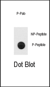 Phospho-TERT(S1125) Antibody