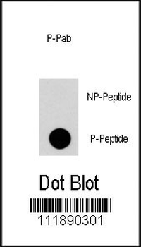 Phospho-RGS19(S24) Antibody