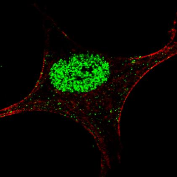 Phospho-STAT5a(Y694) Antibody