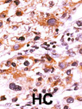 Phospho-FGFR(Y766) Antibody