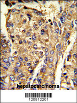 HNRPL Antibody (C-term)