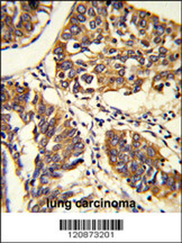 PABPC1 Antibody (Center)