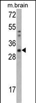 CAPZB Antibody (C-term)