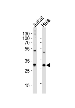 CAPZB Antibody (N-term)