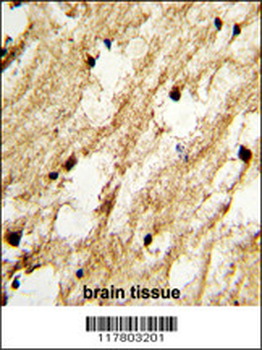 DCC1 Antibody (N-term)