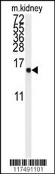 LSM1 Antibody (Center)