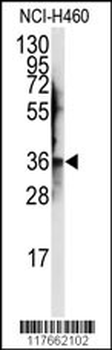 JTV1 Antibody (Center)