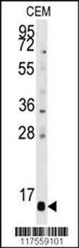 PFDN6 Antibody (N-term)