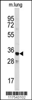 ANXA3 Antibody (Center)