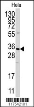 ANXA3 Antibody (N-term)