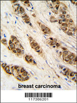 XTP3TPA Antibody (N-term)