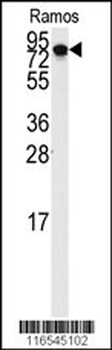 DLG7 Antibody (N-term)