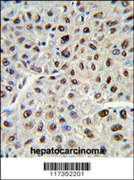 SSB Antibody (C-term)