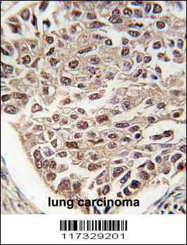 SFRS2 Antibody (N-term)