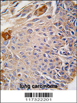 RMND5B Antibody (C-term)