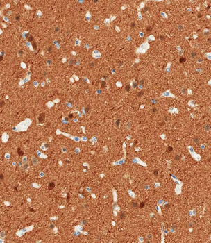 NSE Antibody (Y25)