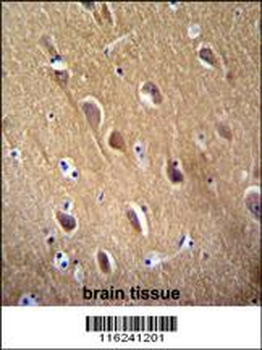 NSE Antibody (Y236)