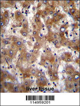 FUT4 Antibody (Center)