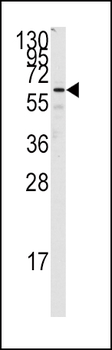FZD1 Antibody (C-term)
