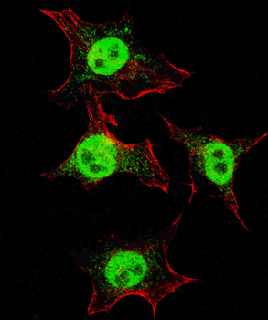 ITGA6 Antibody (isoform 2 S1064)