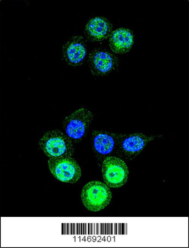 AKR1B1 Antibody (C-term)